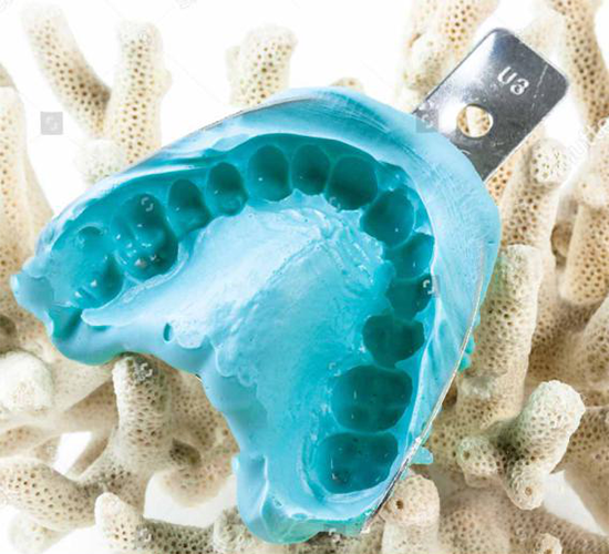 藻酸盐齿科印模材料应用