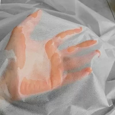 Hydrophilic Nonwoven Fabrics