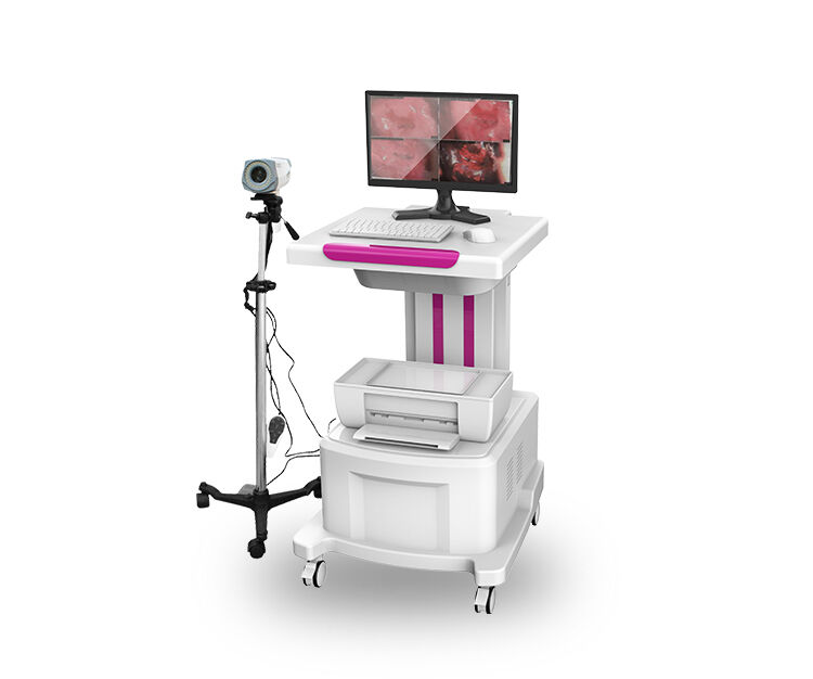 数码电子阴道镜