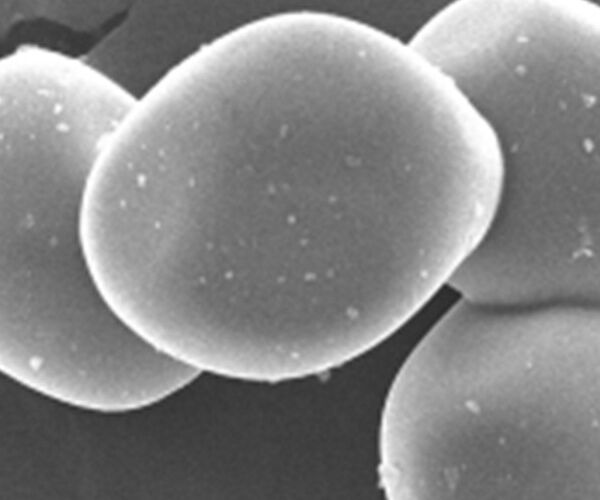 TY-205 导热用高温氧化铝填料