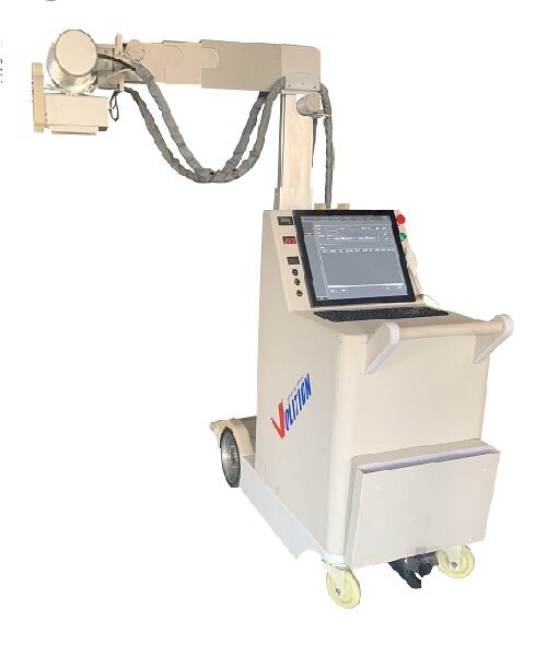 数字化移动式X射线摄影系统