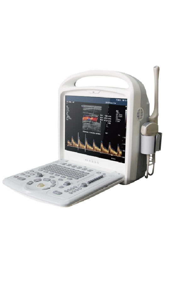 彩色超声多普勒JH-910A款