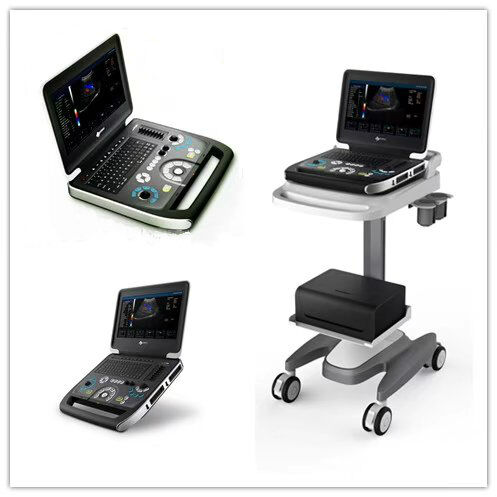 四维彩超检查前需要注意什么