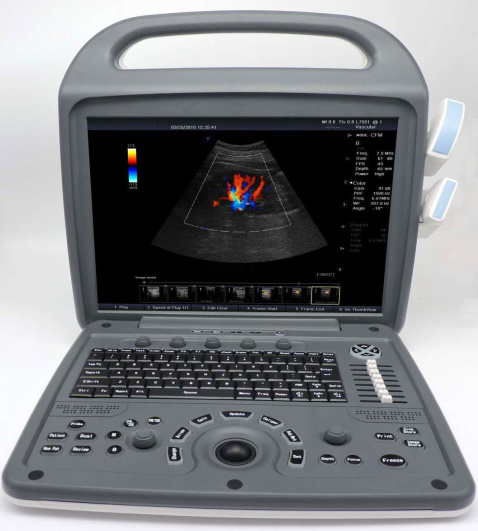 彩超厂家机器使用时的注意事项