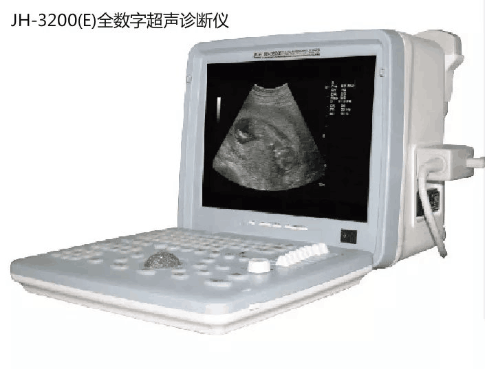 全数字超声诊断仪JH-3200E