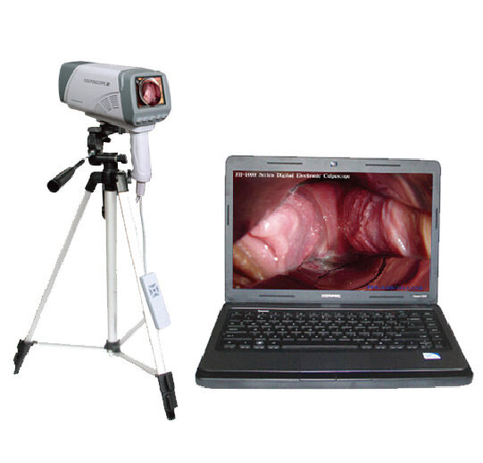 阴 道镜工作原理