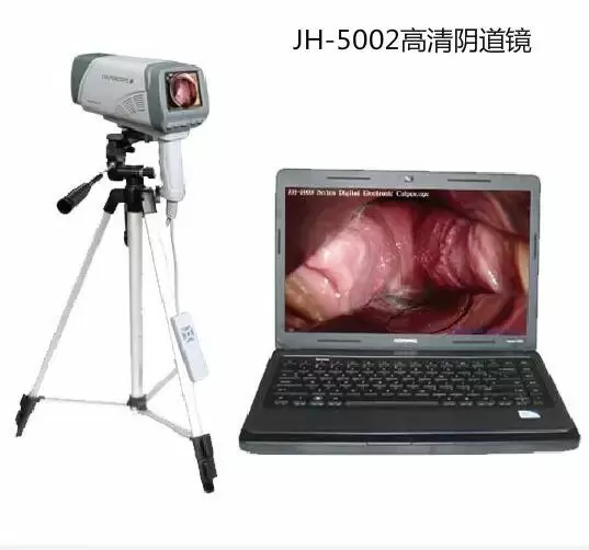 数码电子阴 道镜JH-5002