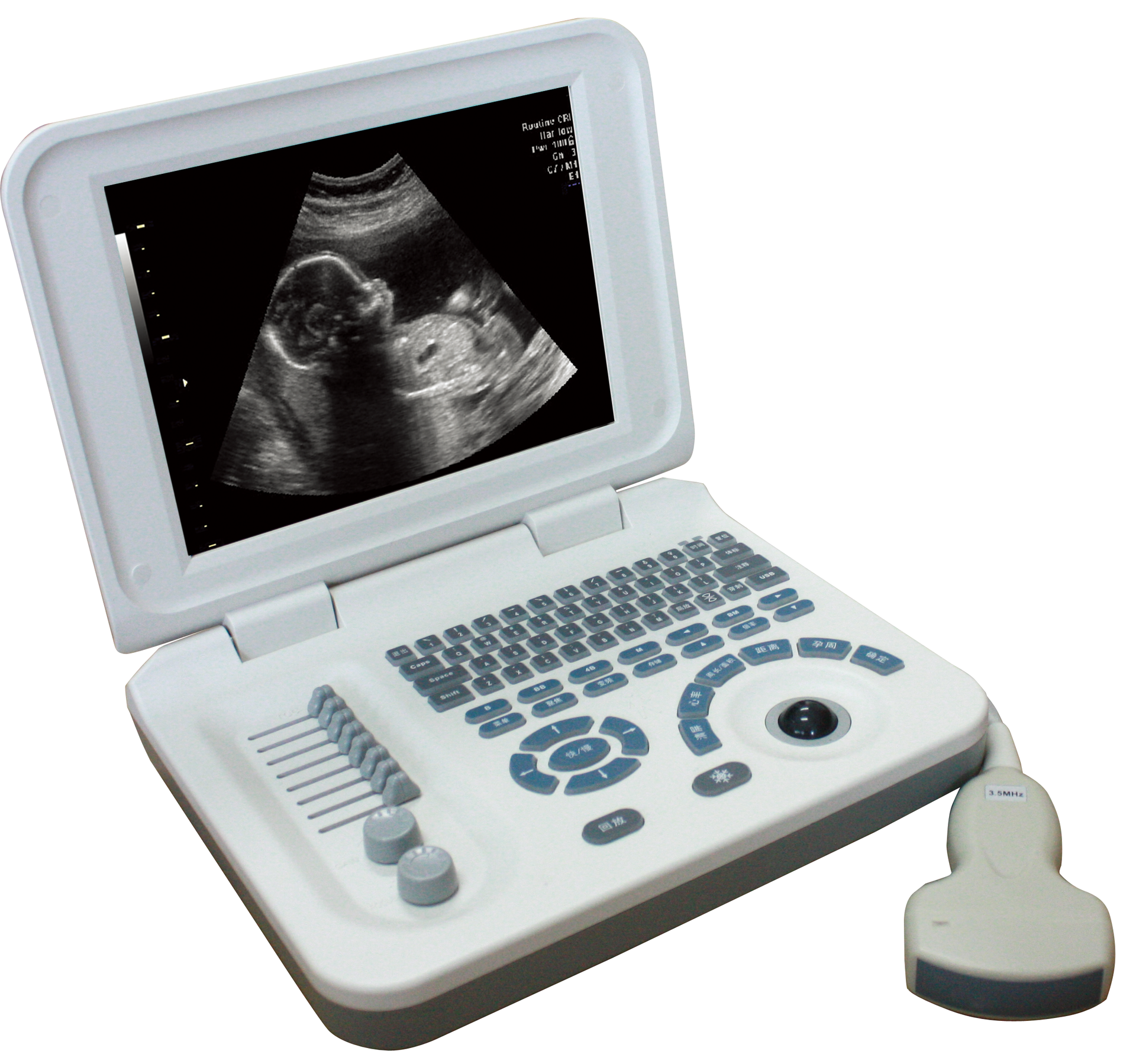 B超厂家生产的机器使用时的注意事项