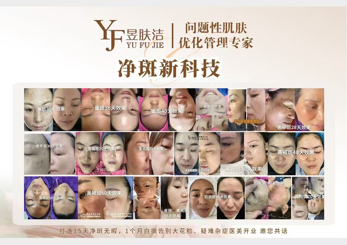 春天不只是花开.斑点也“复苏”! 春天不只是花开.斑点也“复苏”!