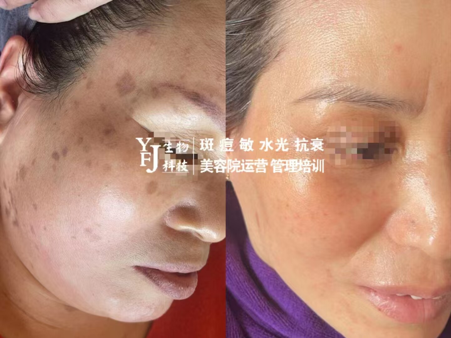 昱肤洁肌肤管理