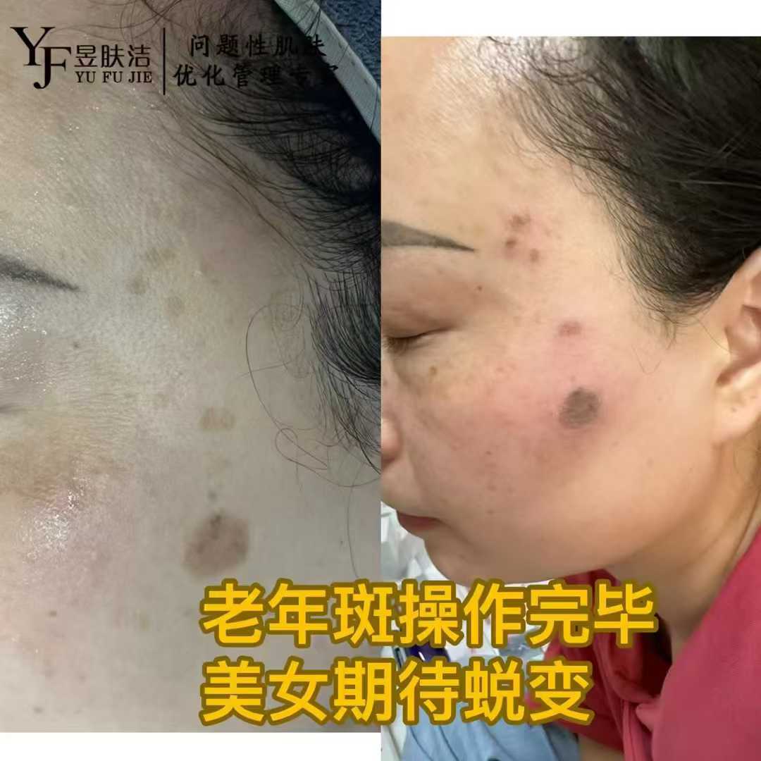 昱肤洁肌肤优化管理