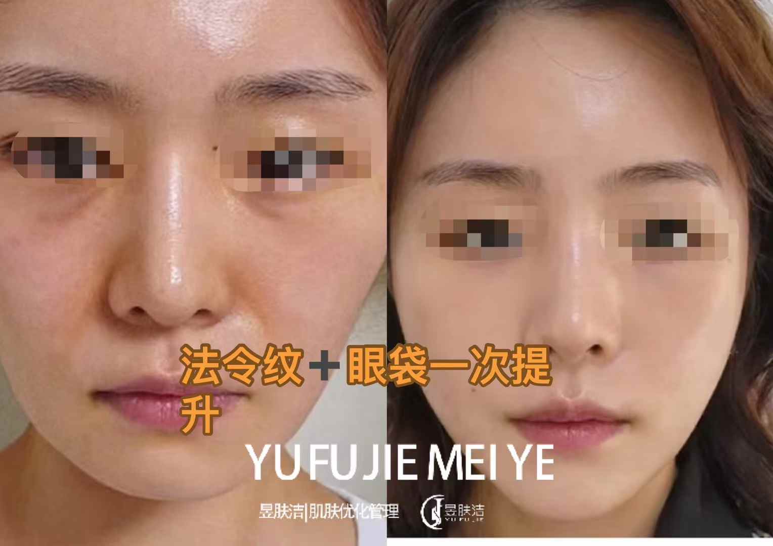 昱肤洁肌肤优化管理