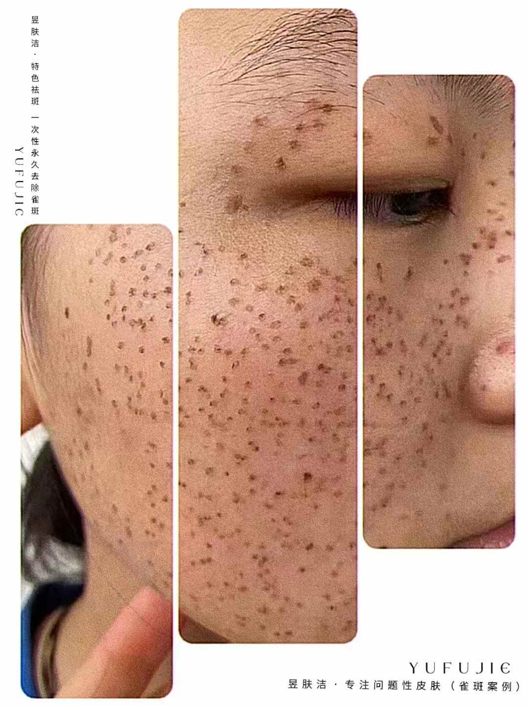 昱肤洁肌肤优化管理