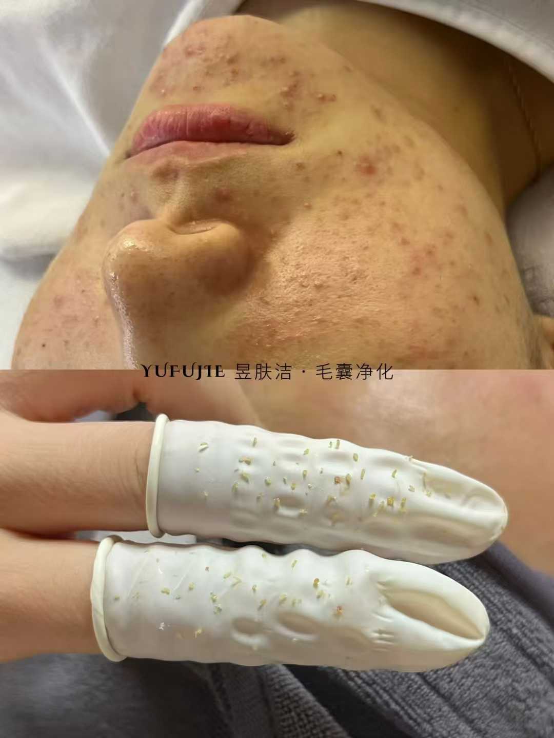 昱肤洁肌肤优化管理