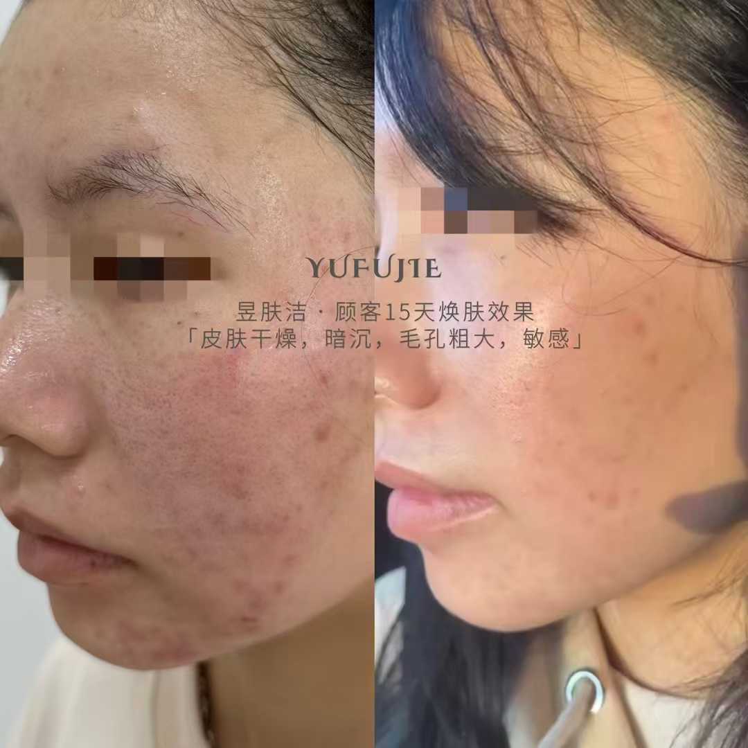 昱肤洁肌肤优化管理中心