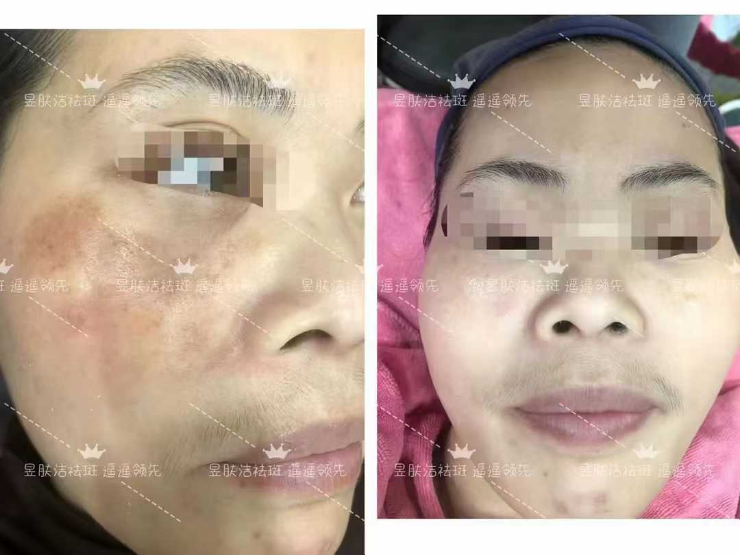 昱肤洁肌肤优化管理