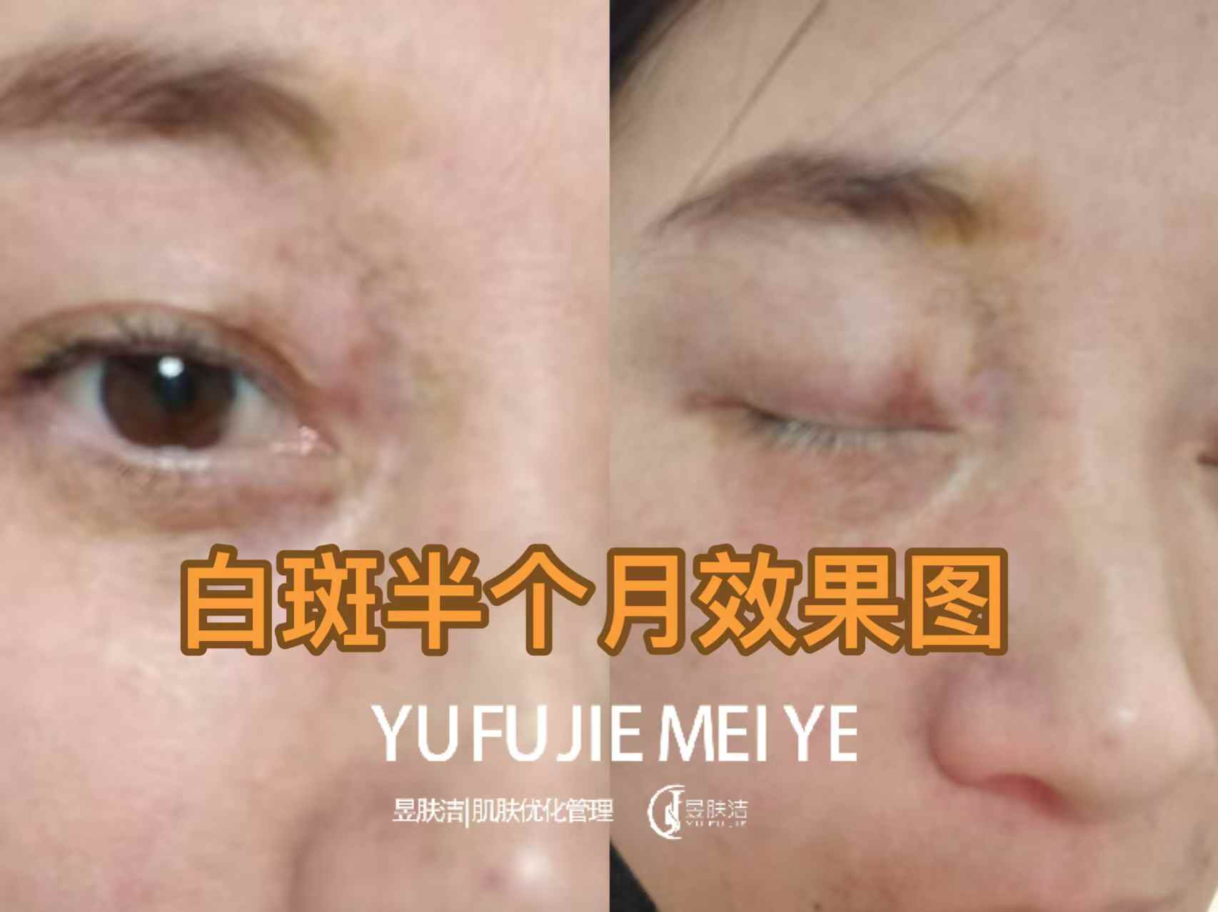 昱肤洁洁肤优化管理