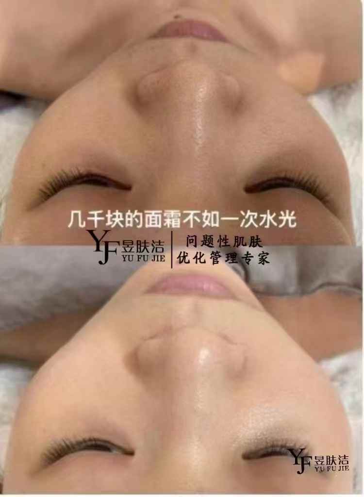 昱肤洁肌肤优化管理