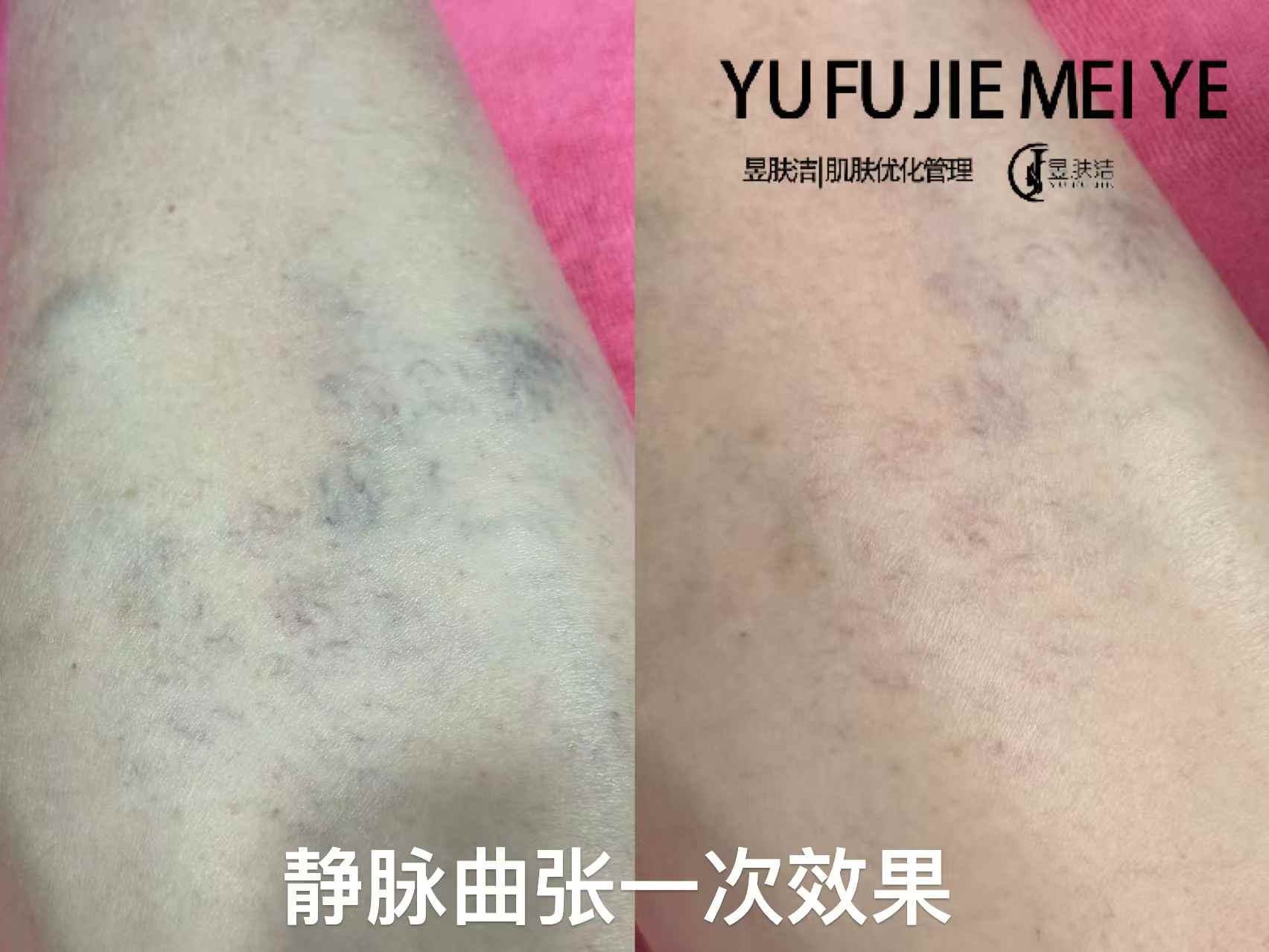 昱肤洁肌肤优化管理