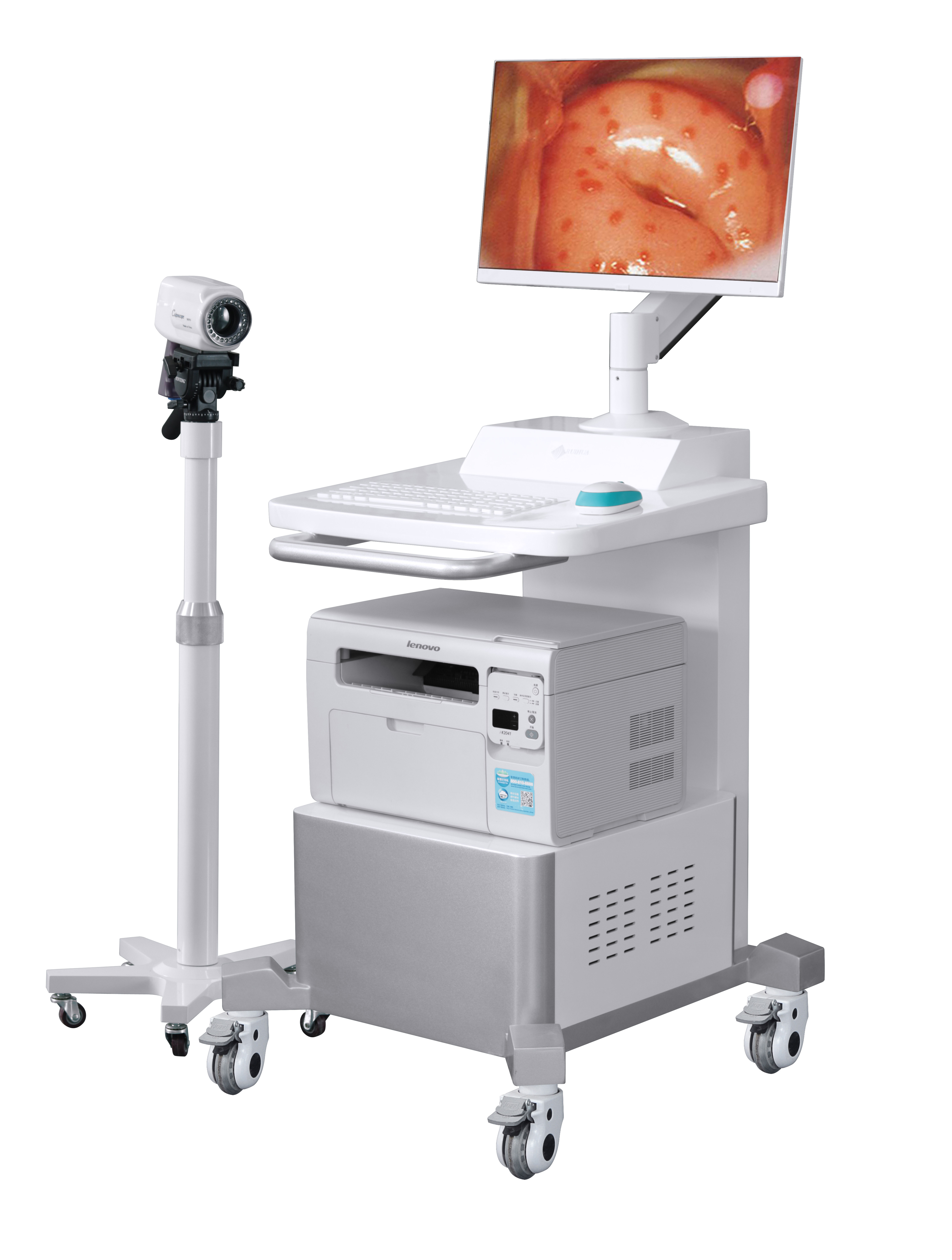 数码电子阴道镜 RH220F