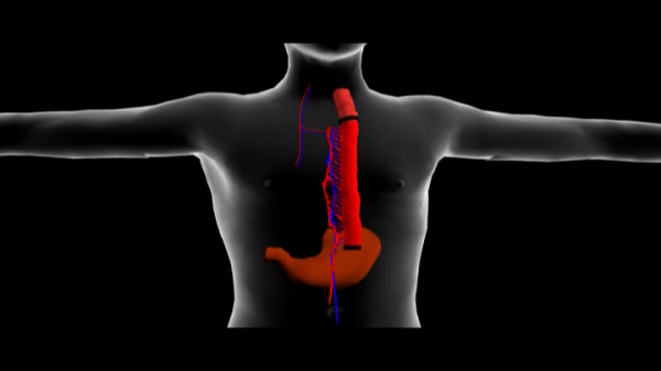 生物动画,机械动画,演示动画,产品动画,三维动画,医疗器械动画
