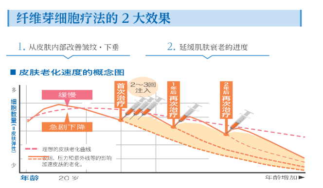 真皮纤维芽细胞疗法