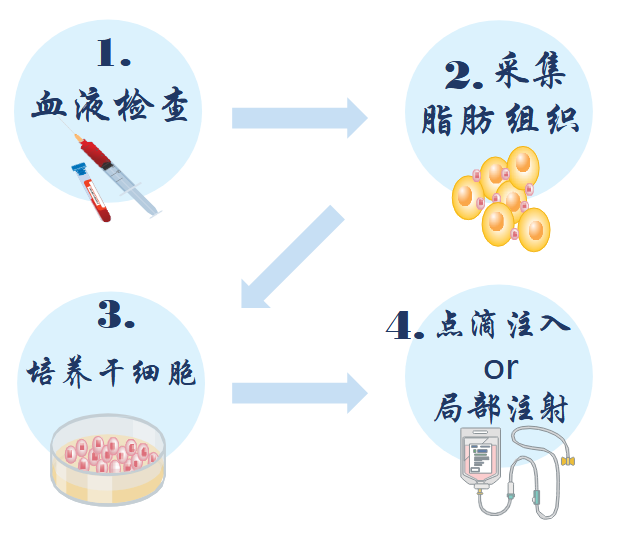 脂肪干细胞疗法