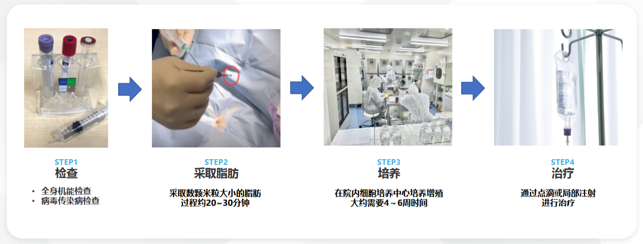 脂肪干细胞流程