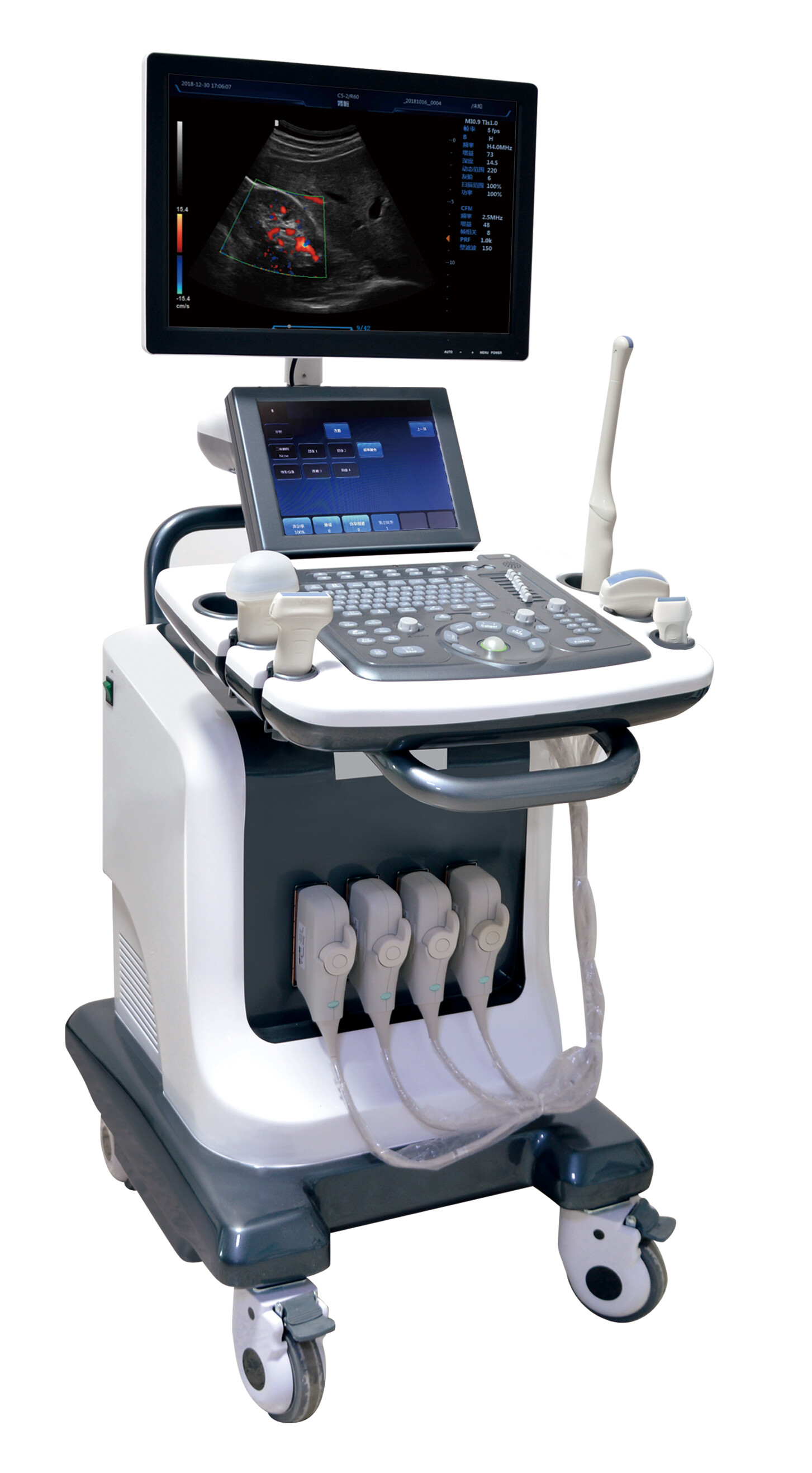 全数字彩色多普勒超声诊断仪BLS-X8