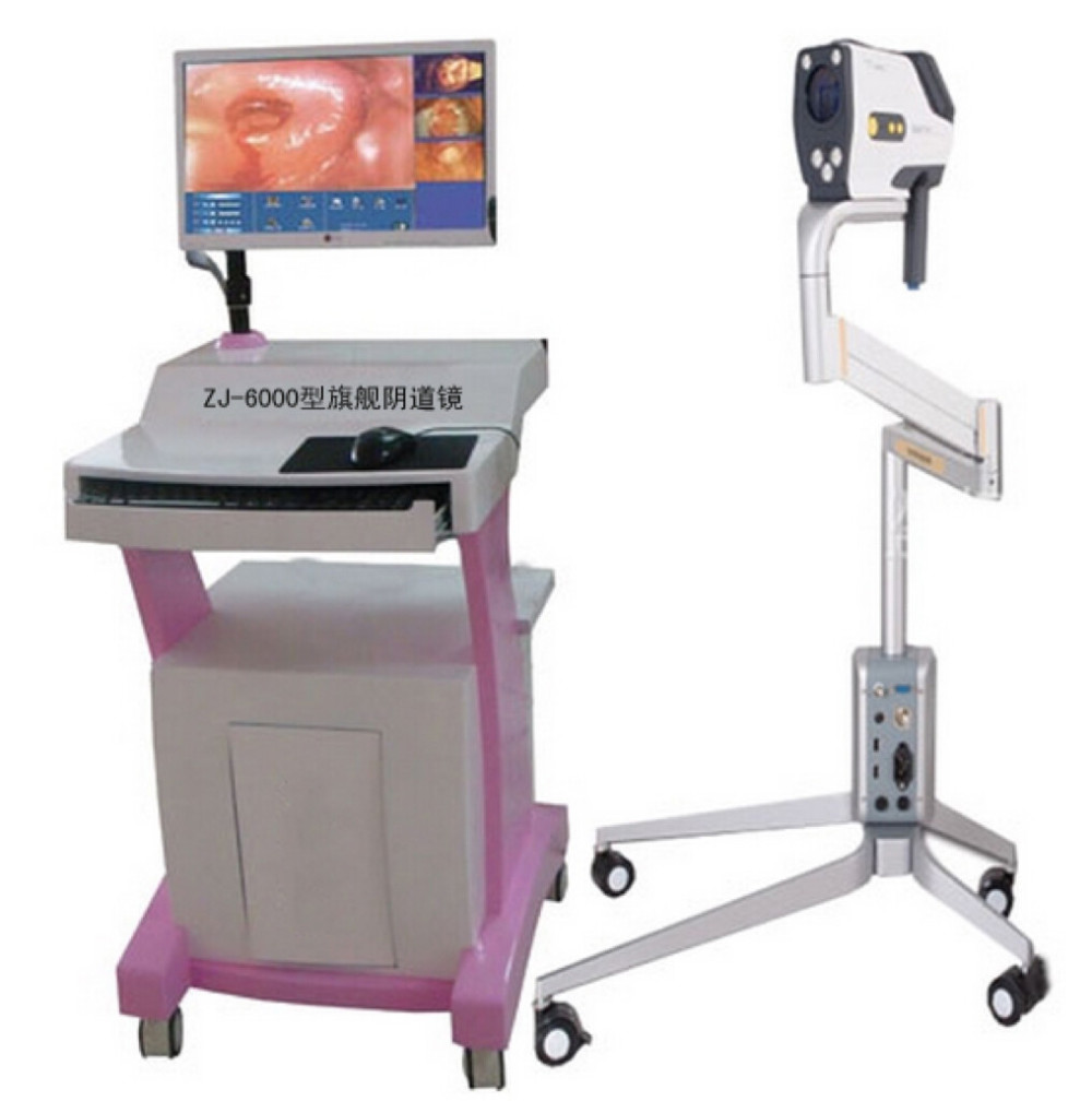 数码电子阴道镜