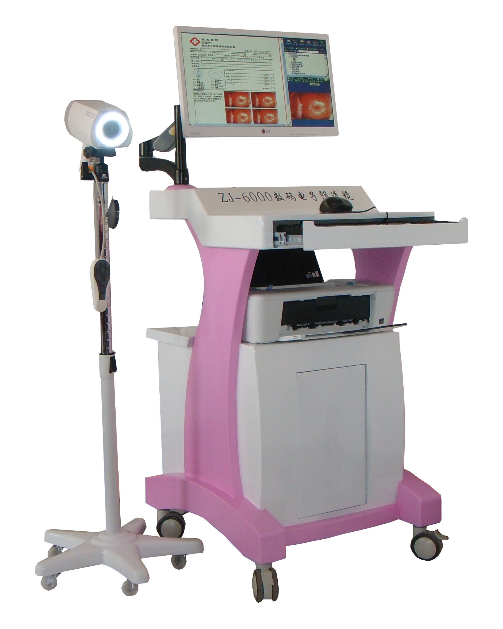 数码电子阴道镜