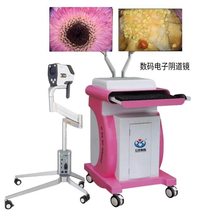 数码电子阴道镜