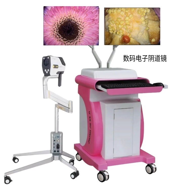 数码电子阴道镜