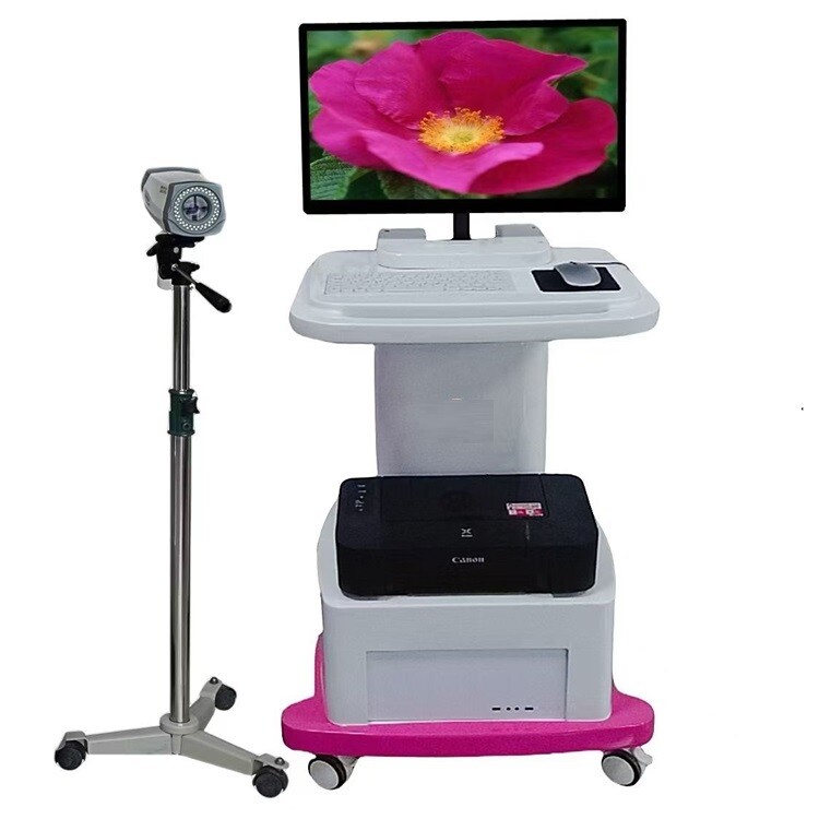 数码电子阴道镜