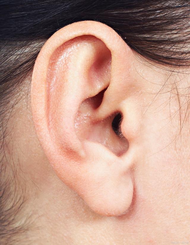 耳聋30年，耳鸣2年病案