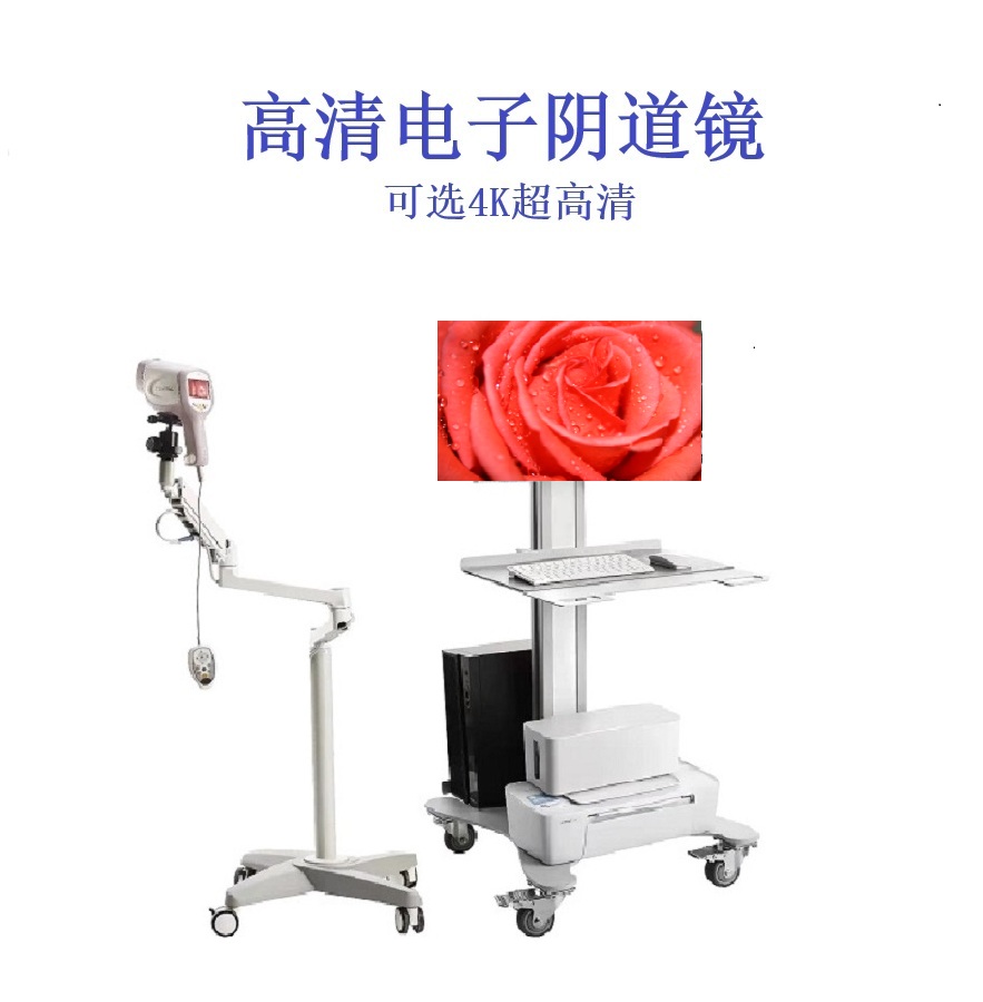 阴道镜数码成像系统 2200A