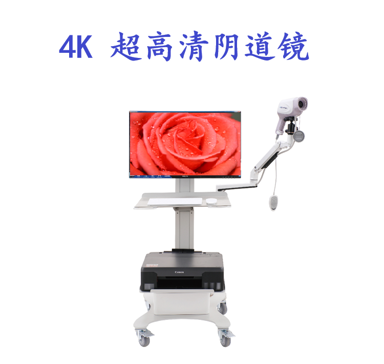 阴道镜数码成像系统-4K超高清